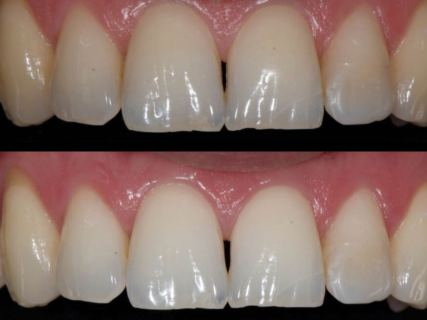 Interview Tim Butterfield Reveals The New White Dental Beauty
